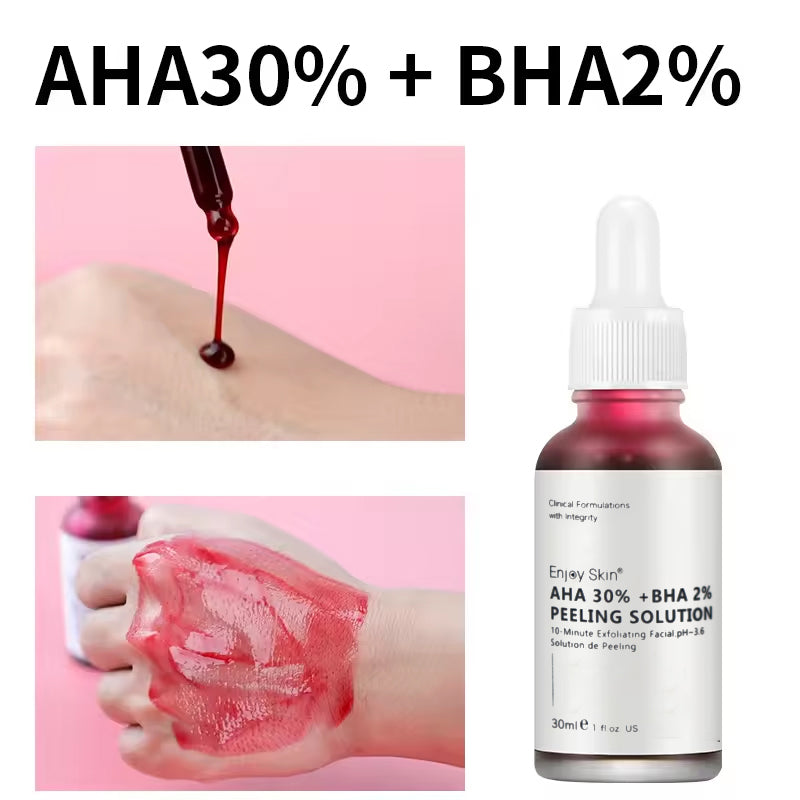 Natural AHA 30% BHA 2% Serum for Deep Skin Exfoliation
