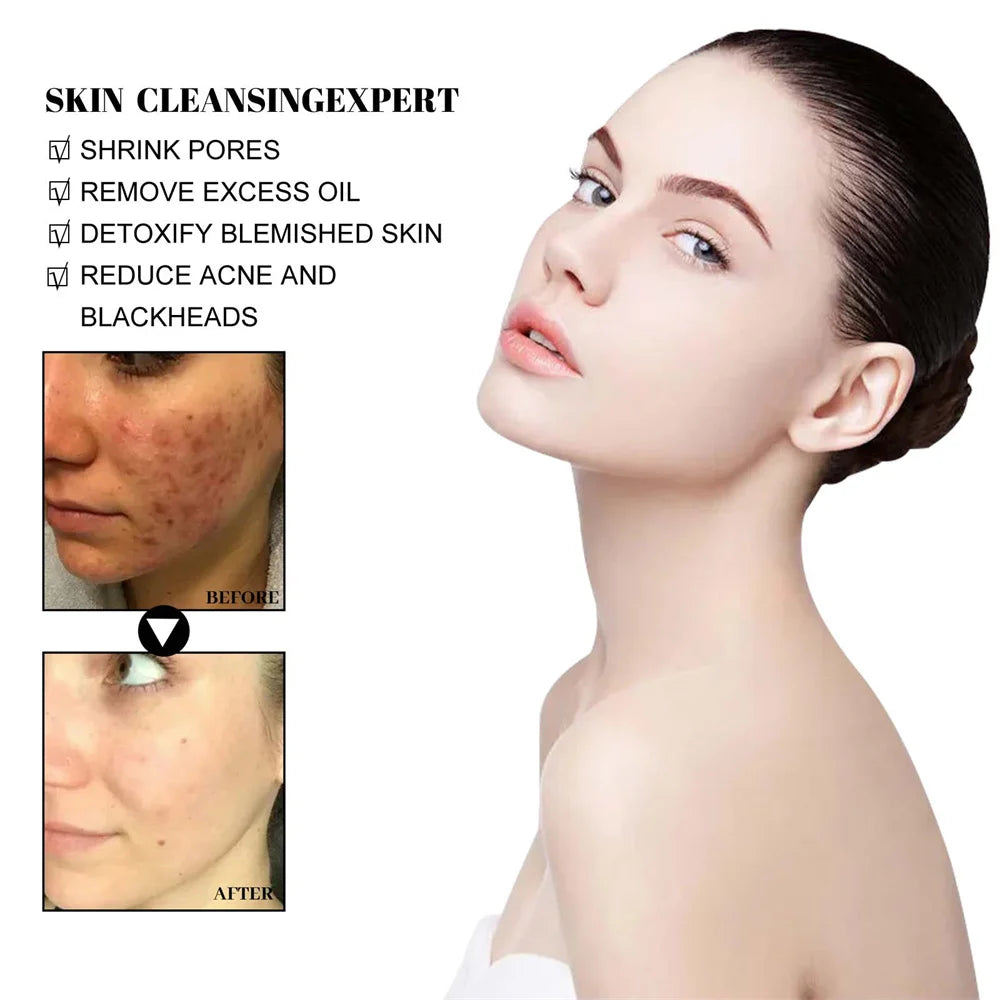 West & Month Blackhead Removal Mud Mask for Oil Control