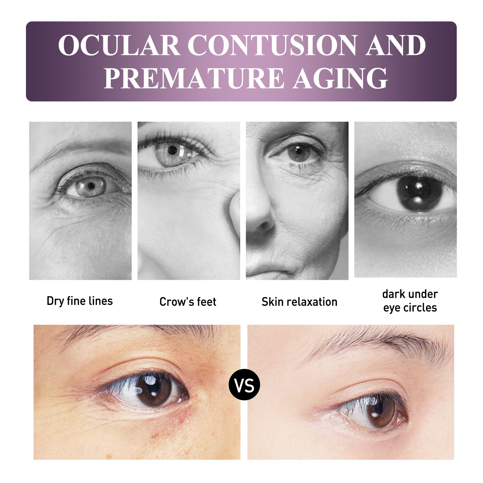Electric Anti-Wrinkle Eye Cream for Lifting, Moisturizing, and Dark Circles